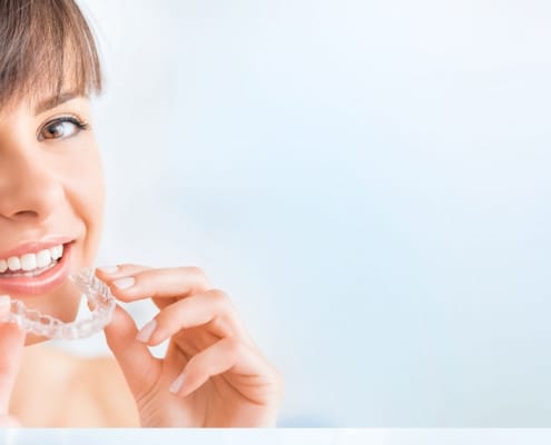 woman about to put in invisible (clear plastic) braces