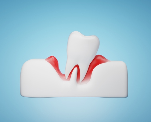 gums and teeth disease